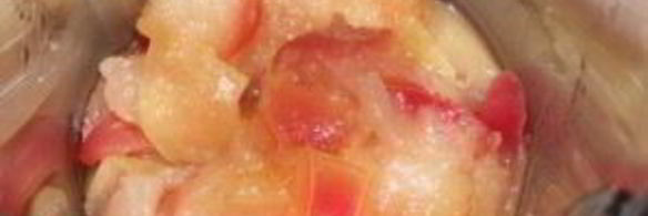 пюре из яблок со сгущенкой