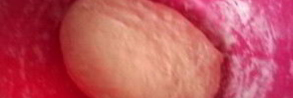 жареные пирожки с рыбой